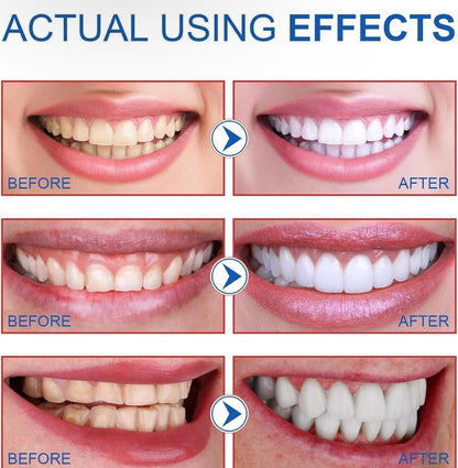 Dentifrice Blanchissant aux probiotiques, Nettoyage en Profondeur & Haleine Fraiche